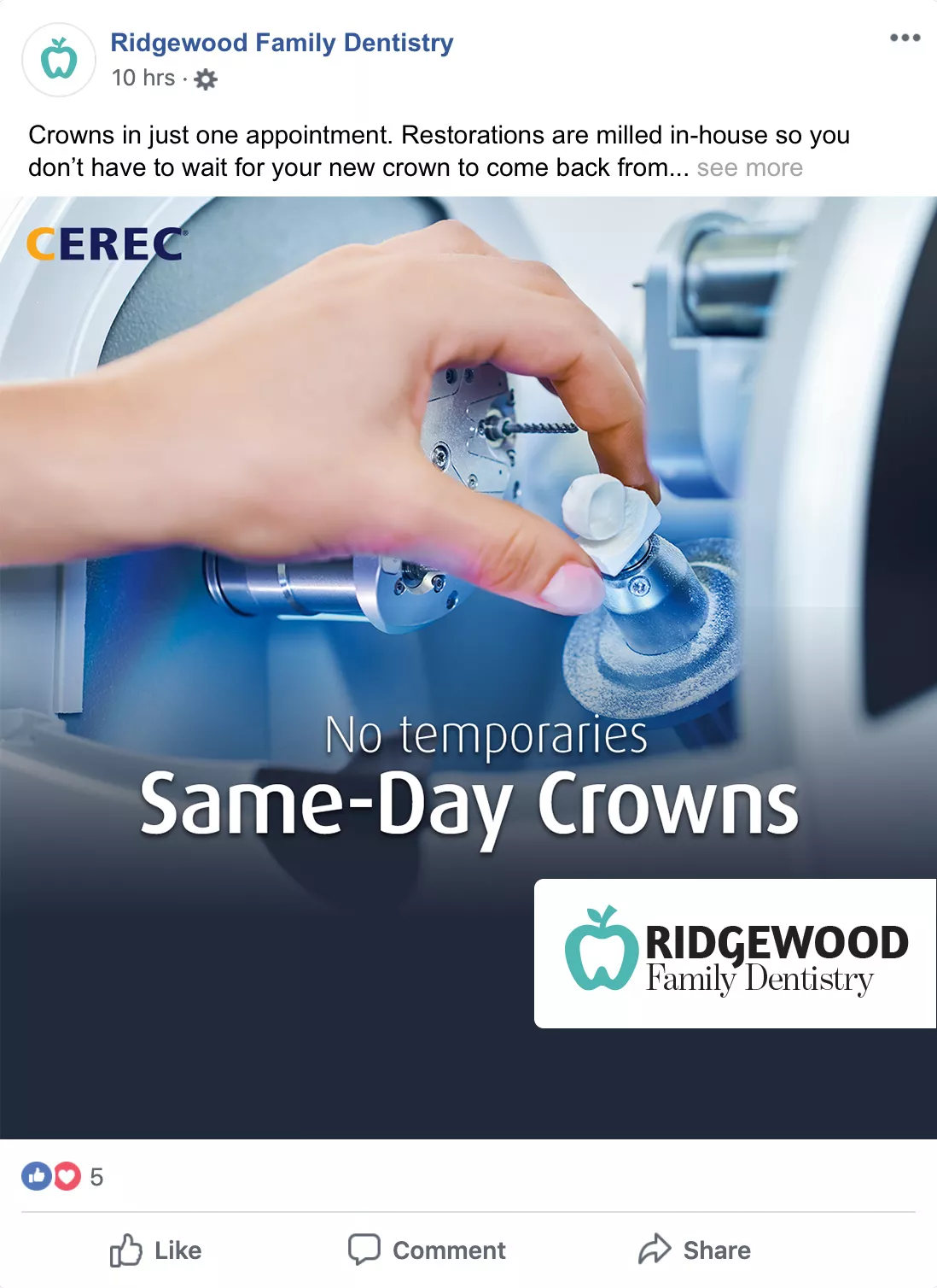Sample Facebook post - same day crowns