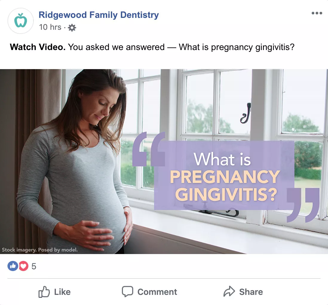 Sample Facebook post - Optio Dentistry Video Pregnancy Gingivitis 