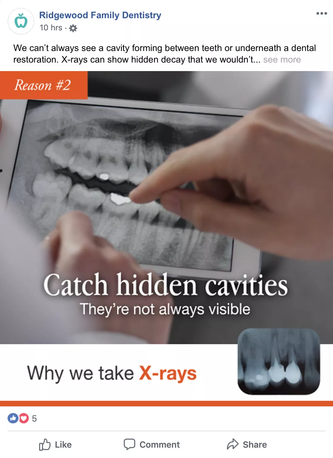 Sample Facebook post - dental xrays