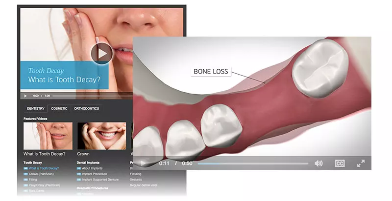 Optio Dentistry video player