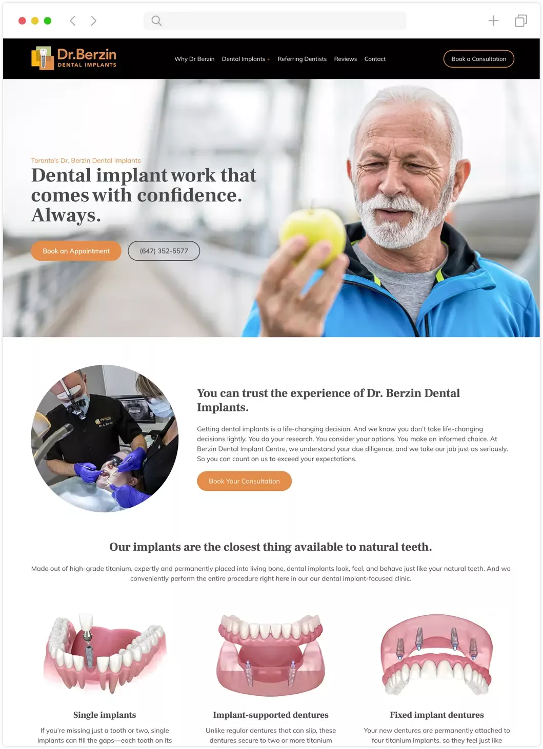 Berzin Implants website